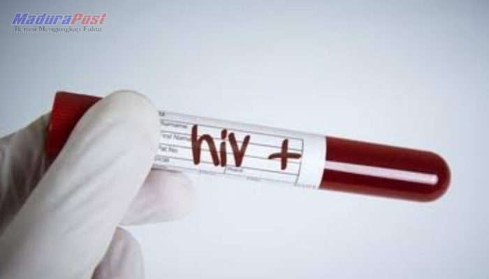 Ada 60 Warga Positif HIV, Dinkes P2KB Sumenep Sebut Tidak Ada Obat Penyembuhan